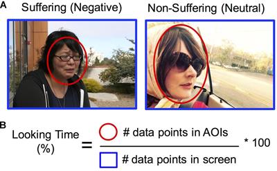 Visual Attention to Suffering After Compassion Training Is Associated With Decreased Amygdala Responses